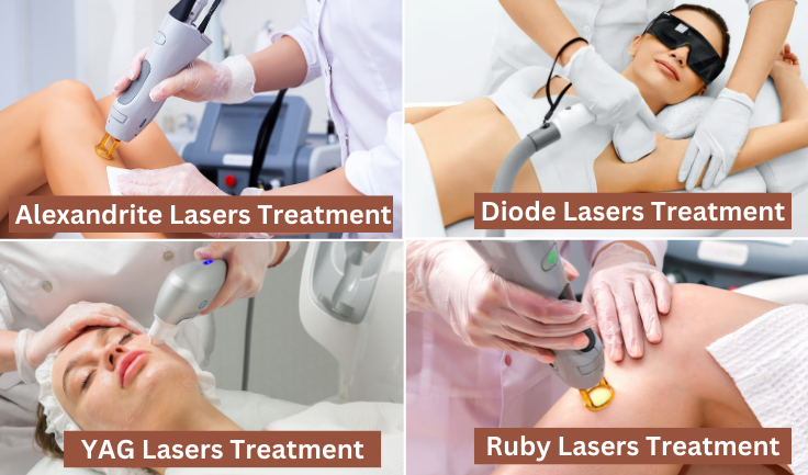 Various skin tones are treated with different types of lasers in best Hair Removal treatment.