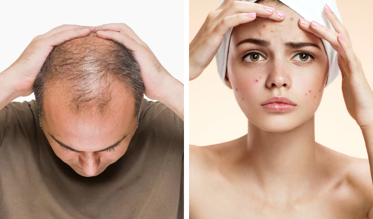 Treatments for hair thinning and skin concerns with holistic care and tips for lasting results.