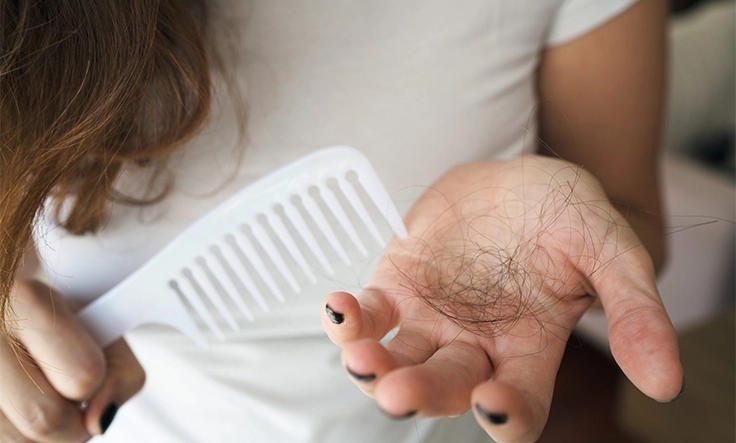 A woman holding a comb and hair strands, showing hair loss due to weight loss effects.