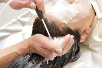 Implement lifestyle changes to manage dandruff and prevent it naturally for a healthy scalp