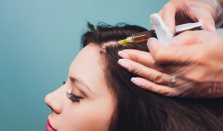 A woman undergoes a hair treatment, showcasing the hair PRP treatment process for revitalization.