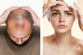 Treatments for hair thinning and skin concerns with holistic care and tips for lasting results