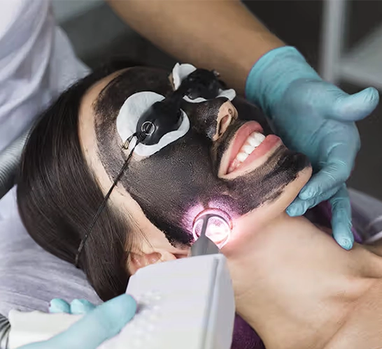 Carbon facial whitening treatment removes acne, reduces oil, unclogs pores & brightens skin.