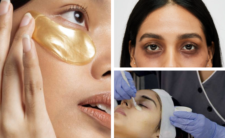  Effective chemical peel treatment to reduce dark circles, rejuvenate skin, and restore a fresh look.